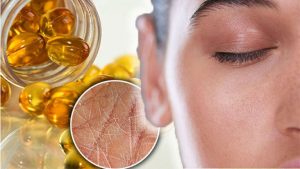 dau hieu nhan biet co the dang thieu hut omega 3