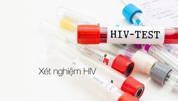 Khi nào xét nghiệm HIV