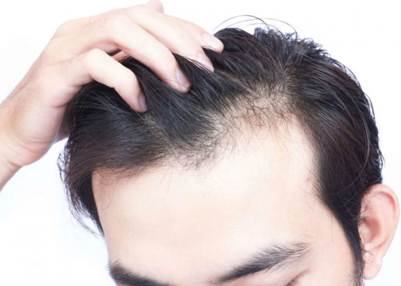 cách để tóc mọc nhanh trong 1 tuần