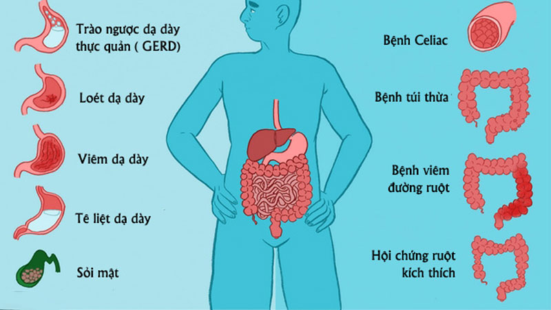 Nguyên nhân chứng biếng ăn ở người lớn và cách điều trị 2 Nguyên nhân chứng biếng ăn ở người lớn và cách điều trị