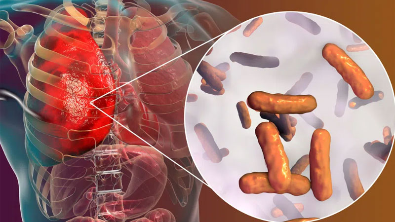 Nguyên nhân chứng biếng ăn ở người lớn và cách điều trị 4 Nguyên nhân chứng biếng ăn ở người lớn và cách điều trị